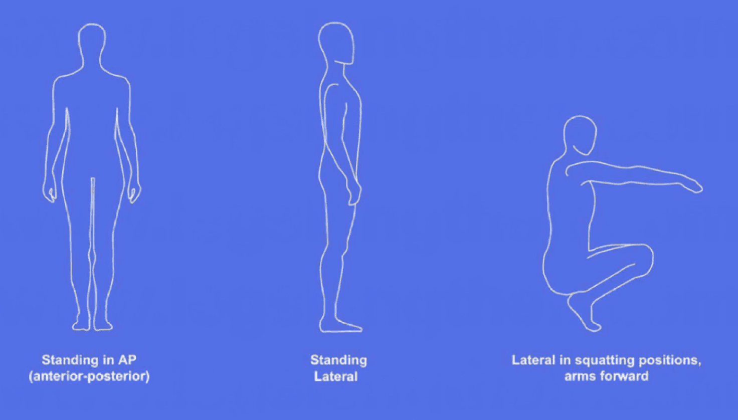 Indications for limb lengthening