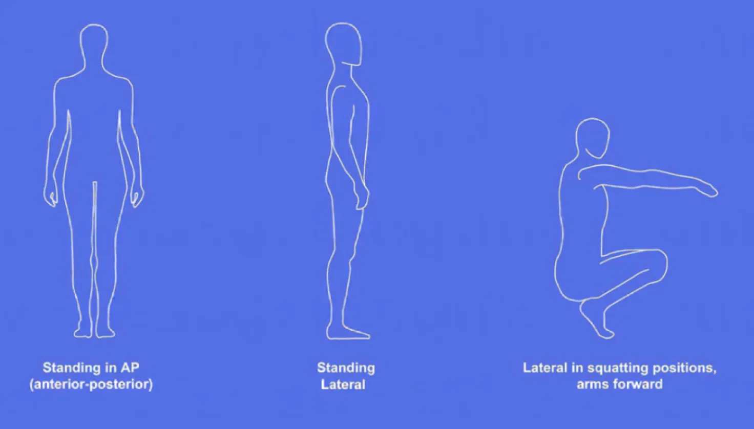 Patient positioning for limb lengthening surgical evaluation