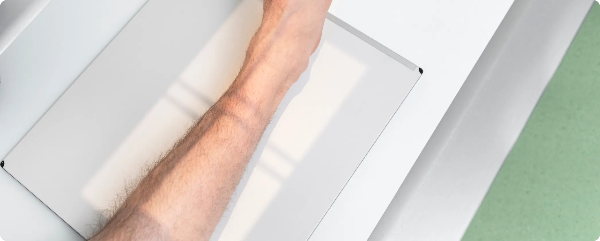 Achondroplasia limb lengthening surgery