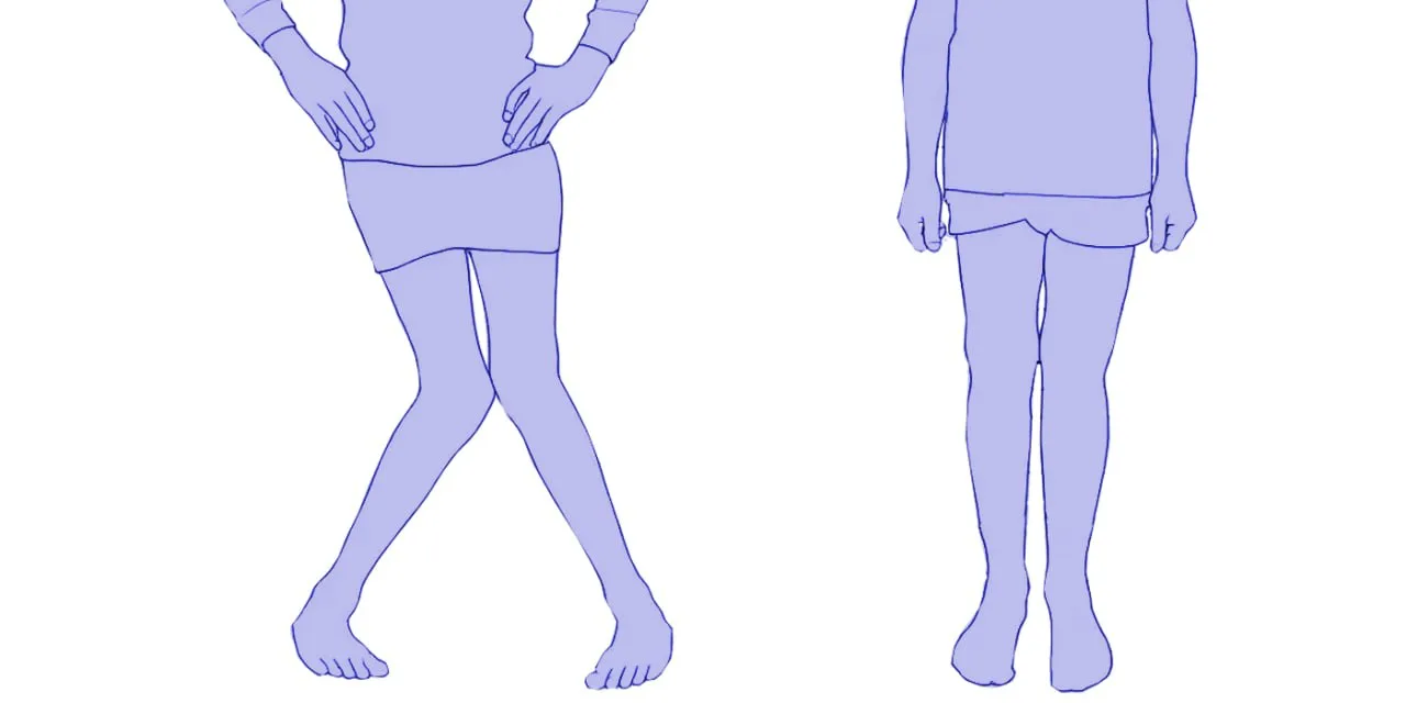 Multiple deformities